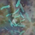 disbakterioz Дисбиоз кишечника - лечение